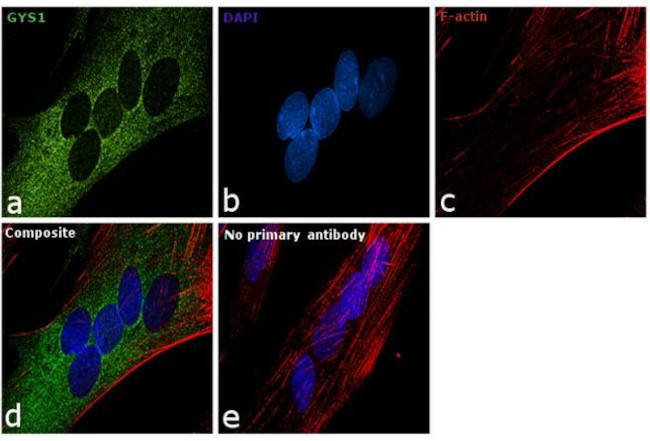 GYS1 Antibody in Immunocytochemistry (ICC/IF)