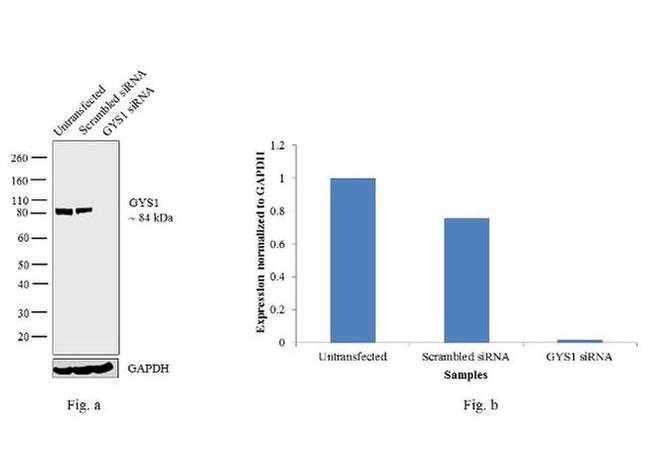 GYS1 Antibody in Western Blot (WB)