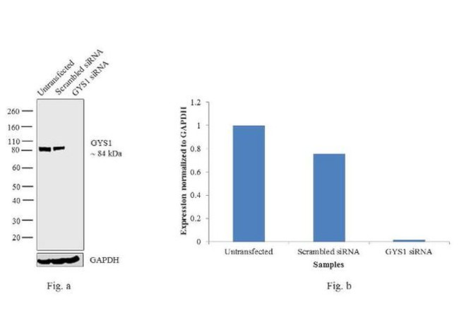 GYS1 Antibody
