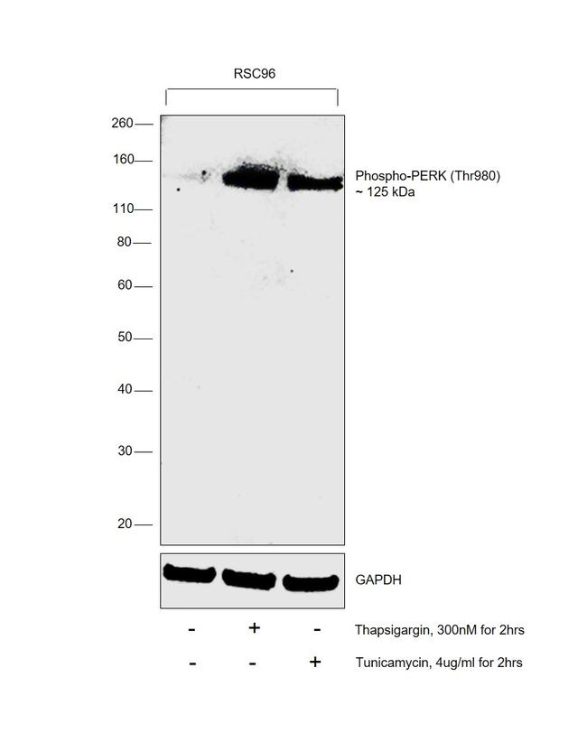 Phospho-PERK (Thr980) Antibody