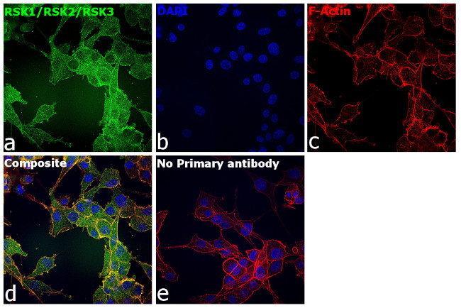 RSK1/RSK2/RSK3 Antibody in Immunocytochemistry (ICC/IF)