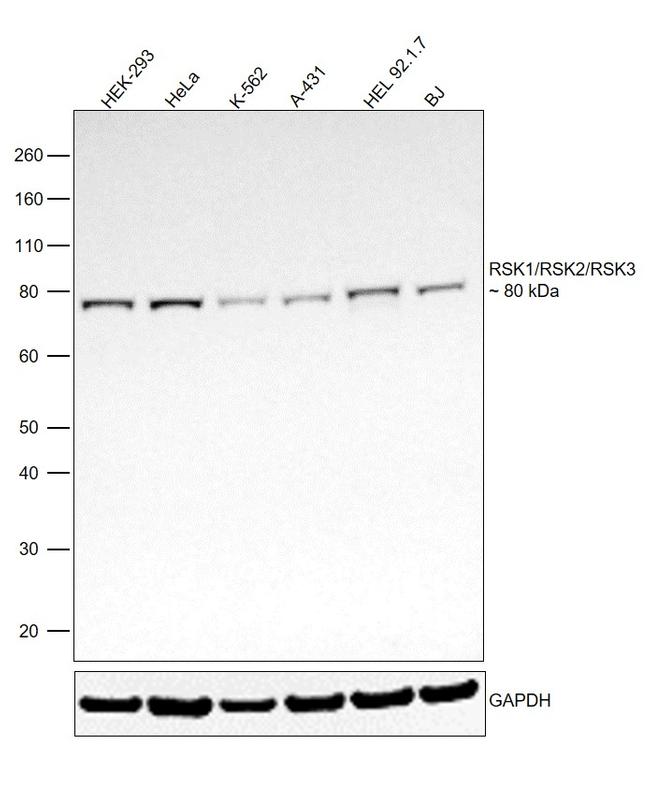 RSK1/RSK2/RSK3 Antibody in Western Blot (WB)