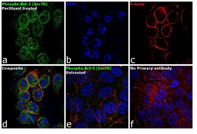 Phospho-Bcl-2 (Ser70) Antibody