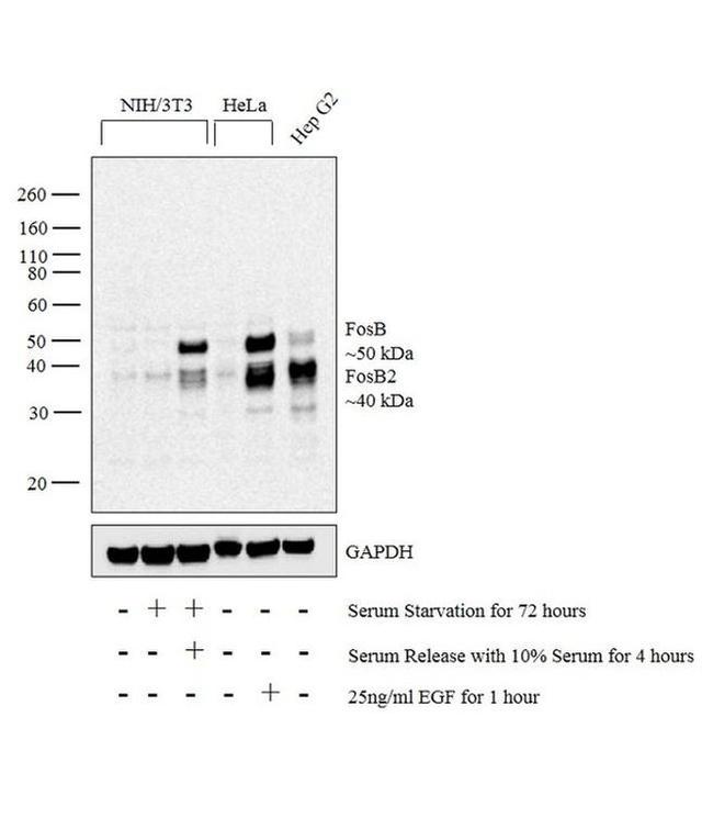 FosB Antibody in Western Blot (WB)