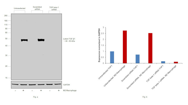 TGF beta-1 Antibody