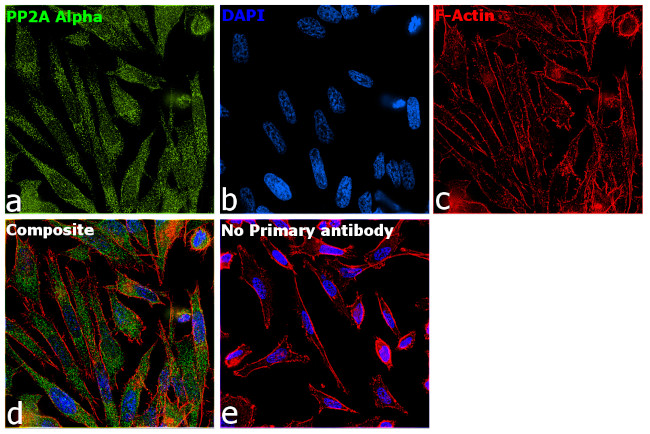 PP2A alpha Antibody in Immunocytochemistry (ICC/IF)