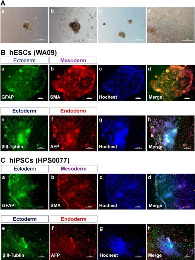 GFAP Antibody in Immunocytochemistry (ICC/IF)