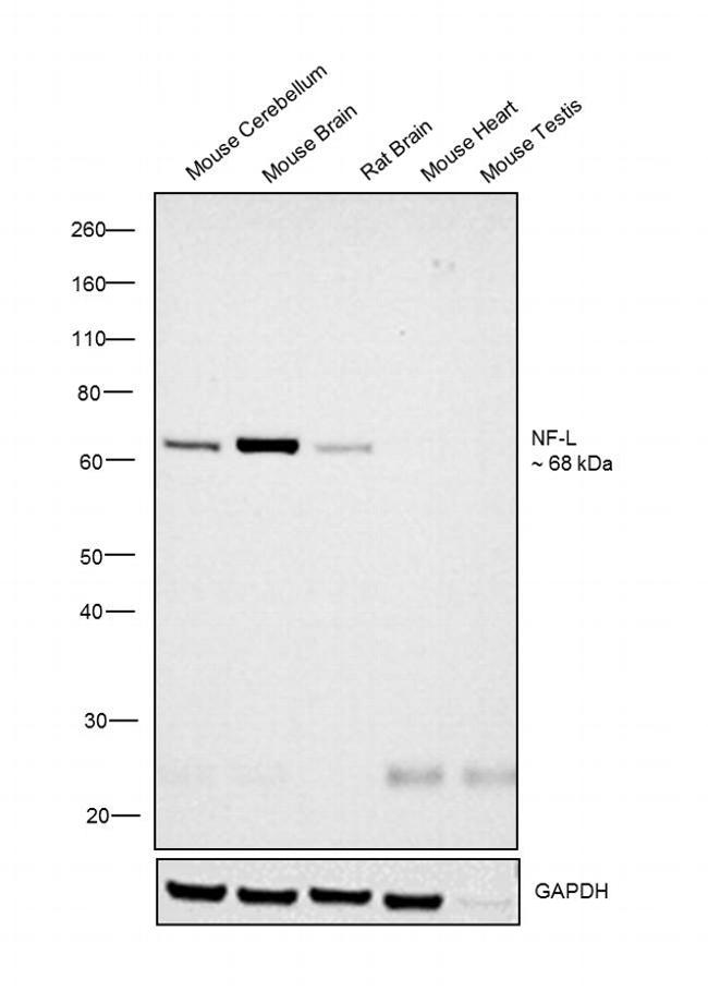 NEFL Antibody in Western Blot (WB)