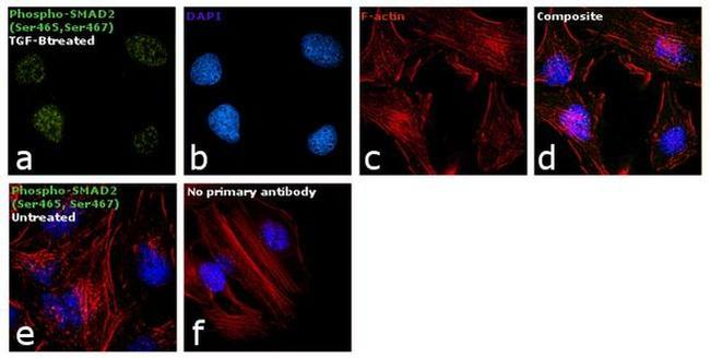 Phospho-SMAD2 (Ser465, Ser467) Antibody