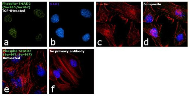 Phospho-SMAD2 (Ser465, Ser467) Antibody in Immunocytochemistry (ICC/IF)