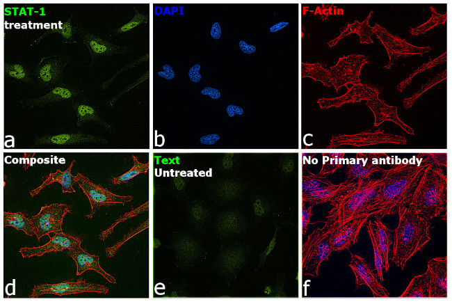 STAT1 Antibody in Immunocytochemistry (ICC/IF)