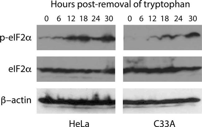 EIF2S1 Antibody in Western Blot (WB)