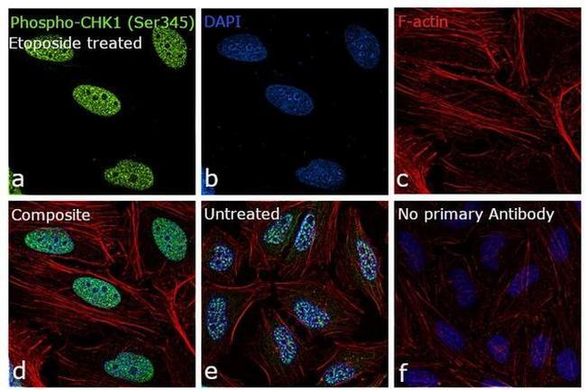 Phospho-CHK1 (Ser345) Antibody