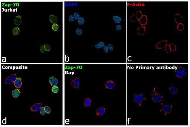 Zap-70 Antibody in Immunocytochemistry (ICC/IF)