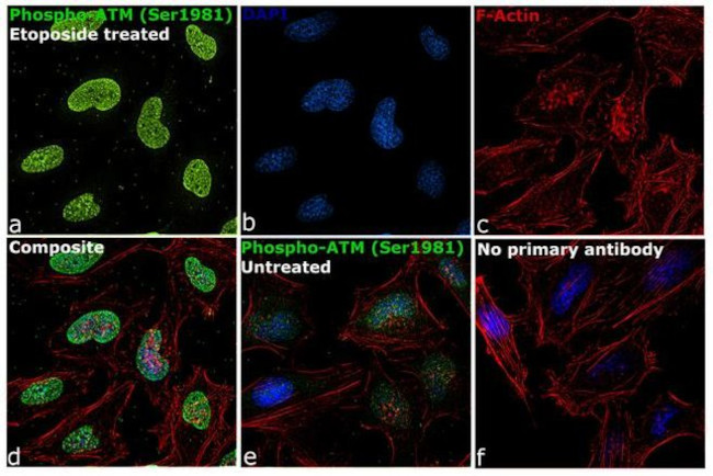 Phospho-ATM (Ser1981) Antibody in Immunocytochemistry (ICC/IF)