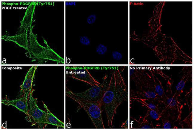 Phospho-PDGFRB (Tyr751) Antibody