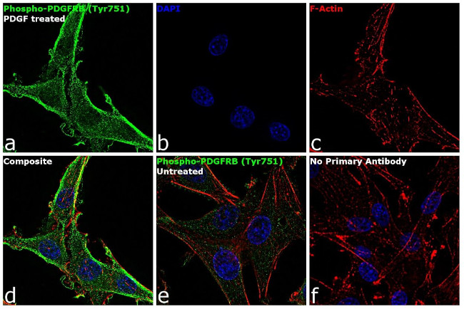 Phospho-PDGFRB (Tyr751) Antibody in Immunocytochemistry (ICC/IF)