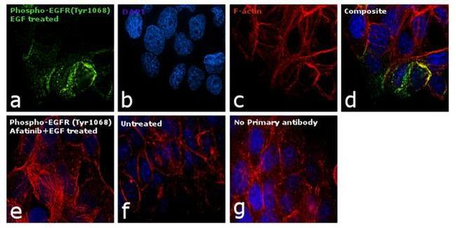 Phospho-EGFR (Tyr1068) Antibody