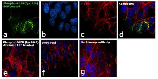 Phospho-EGFR (Tyr1068) Antibody in Immunocytochemistry (ICC/IF)