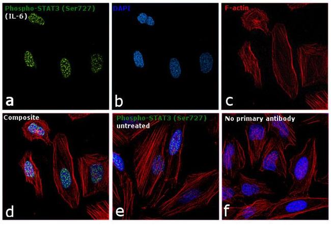 Phospho-STAT3 (Ser727) Antibody