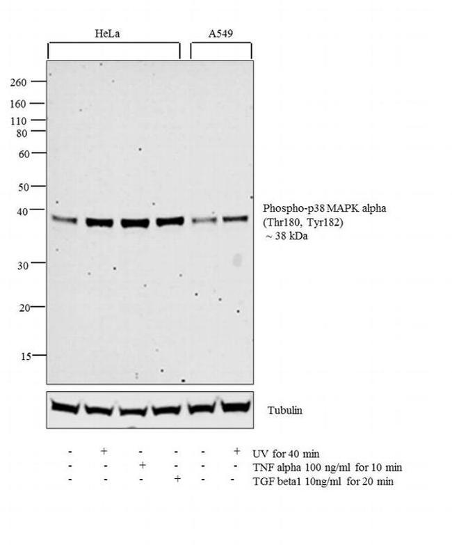 Phospho-p38 MAPK (Thr180, Tyr182) Antibody in Western Blot (WB)