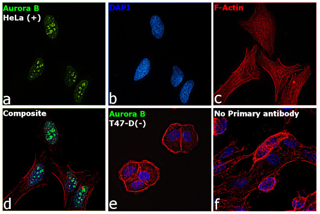 Aurora B Antibody in Immunocytochemistry (ICC/IF)