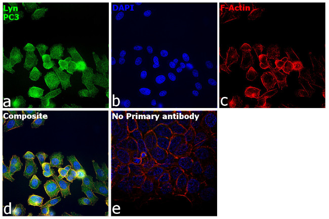 Lyn Antibody in Immunocytochemistry (ICC/IF)