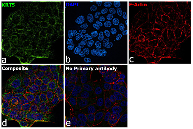 Cytokeratin 5 Antibody in Immunocytochemistry (ICC/IF)