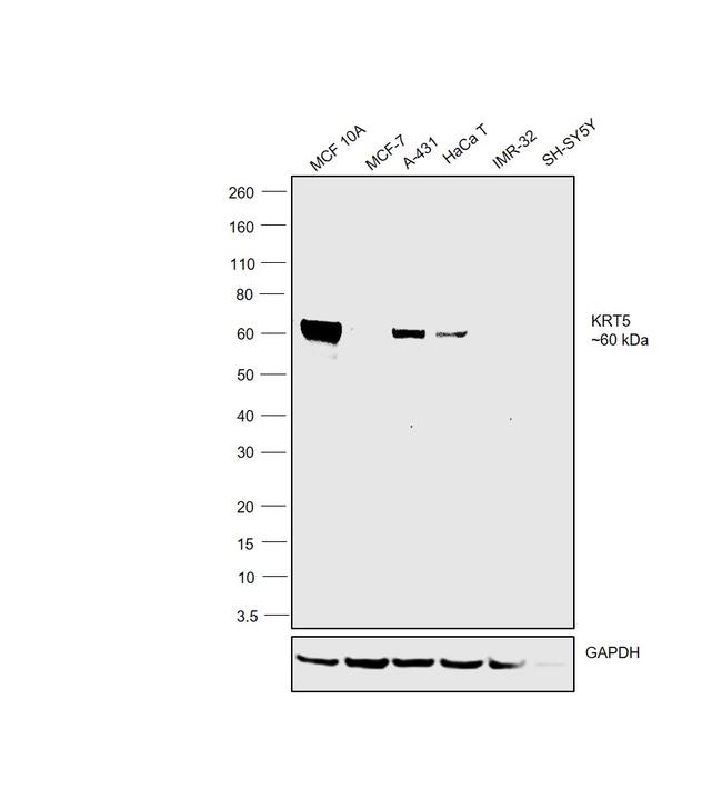 Cytokeratin 5 Antibody in Western Blot (WB)