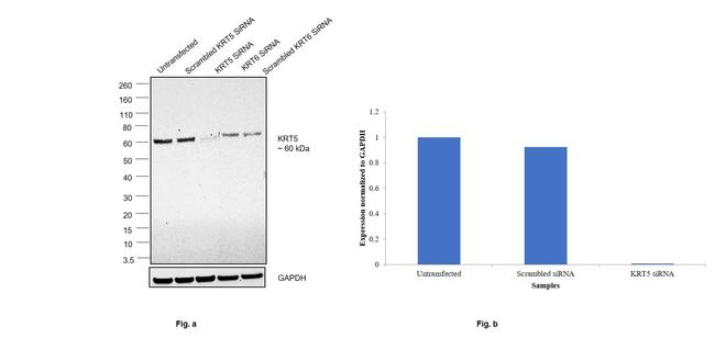 Cytokeratin 5 Antibody in Western Blot (WB)