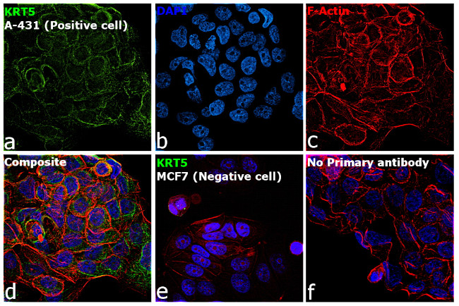 Cytokeratin 5 Antibody