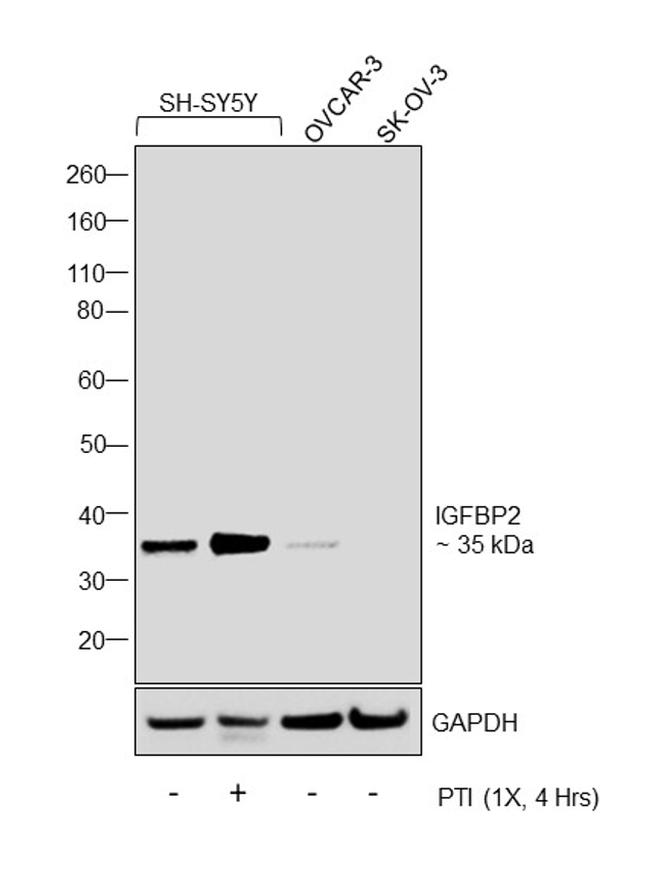 IGFBP2 Antibody in Western Blot (WB)