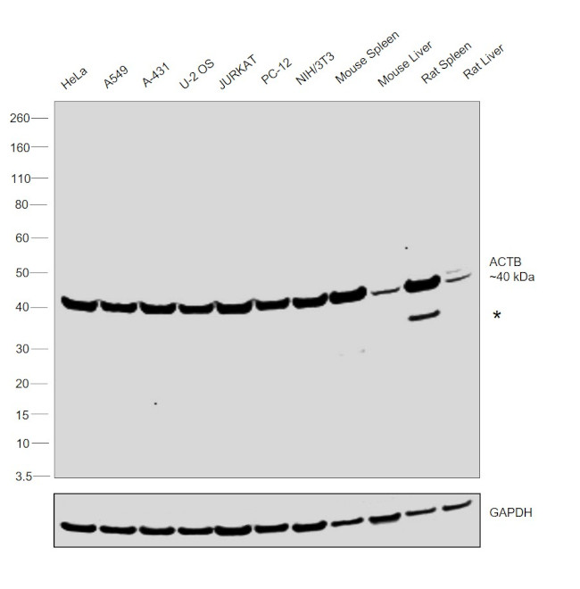 beta Actin Antibody