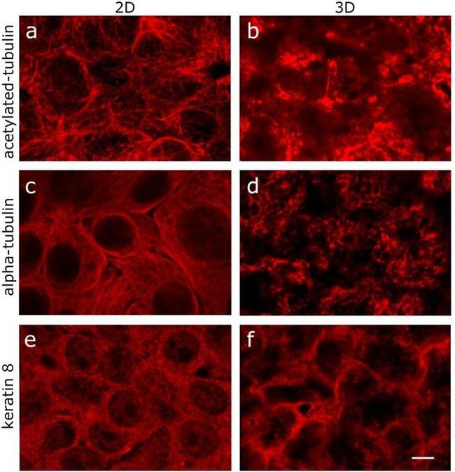 Cytokeratin 8 Antibody in Immunocytochemistry (ICC/IF)