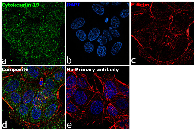 Cytokeratin 19 Antibody in Immunocytochemistry (ICC/IF)