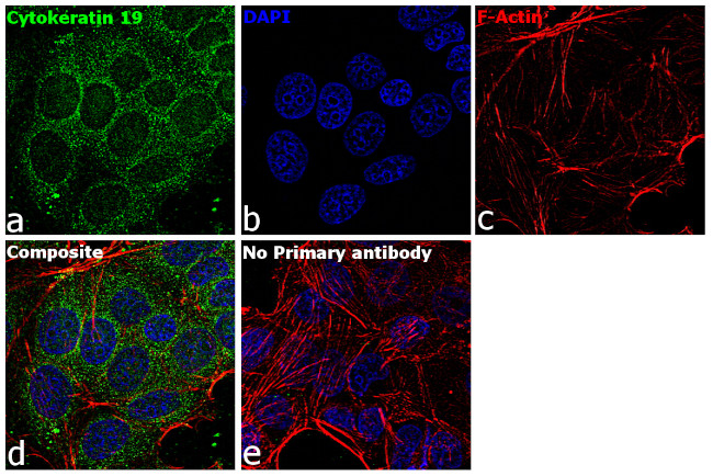 Cytokeratin 19 Antibody in Immunocytochemistry (ICC/IF)