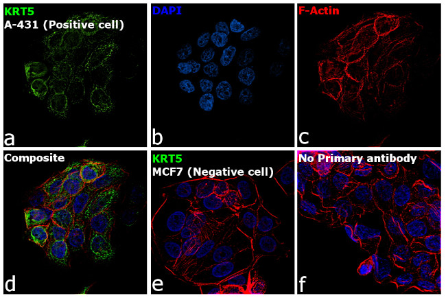 Cytokeratin 5 Antibody in Immunocytochemistry (ICC/IF)