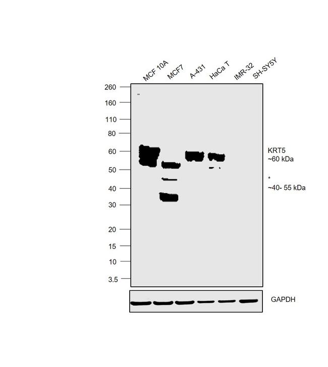 Cytokeratin 5 Antibody in Western Blot (WB)