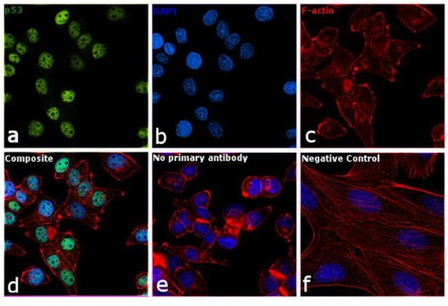 p53 Antibody in Immunocytochemistry (ICC/IF)