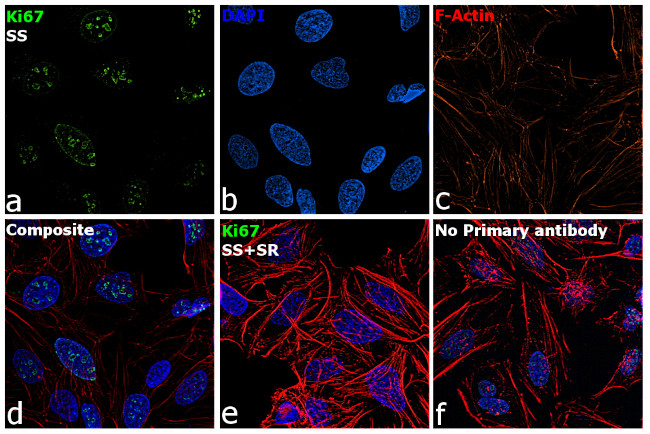 Ki-67 Antibody in Immunocytochemistry (ICC/IF)