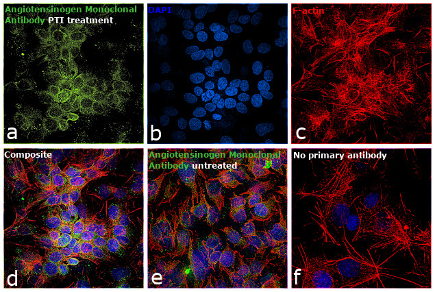 Angiotensinogen Antibody in Immunocytochemistry (ICC/IF)