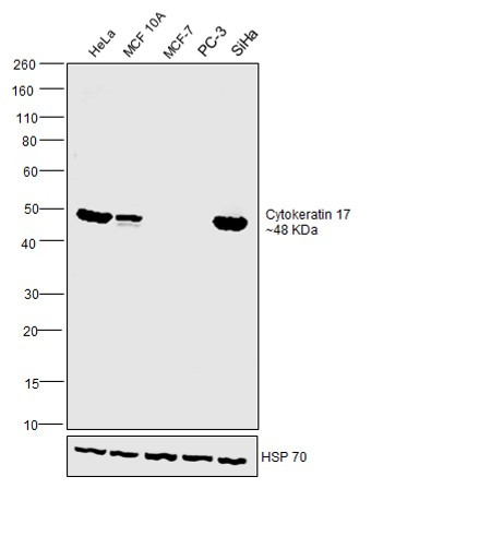 Cytokeratin 17 Antibody