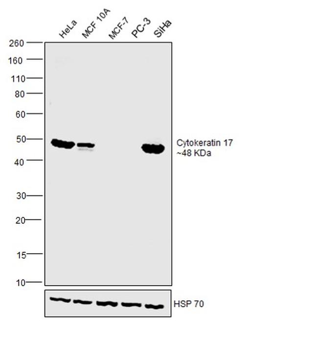 Cytokeratin 17 Antibody in Western Blot (WB)