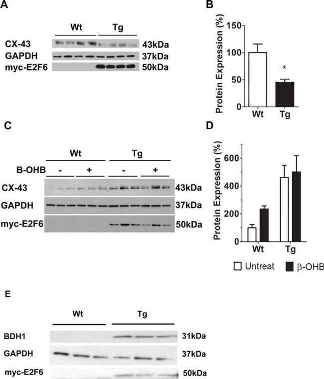 BDH1 Antibody in Western Blot (WB)