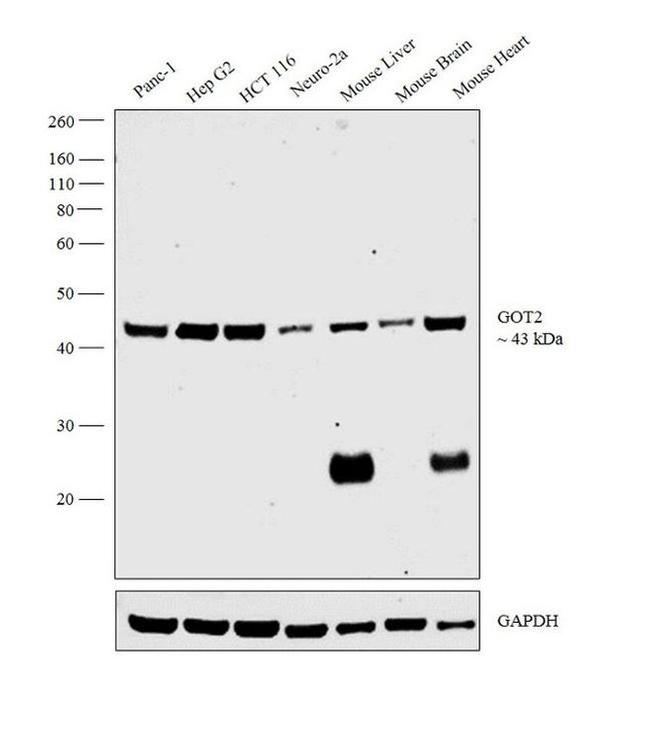 GOT2 Antibody in Western Blot (WB)