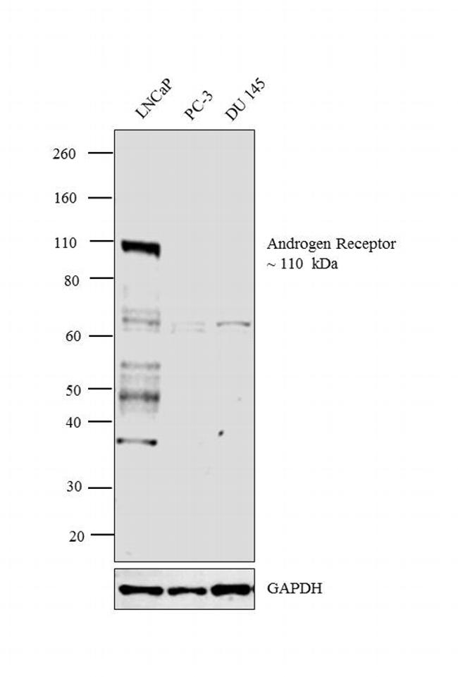 Androgen Receptor Antibody in Western Blot (WB)