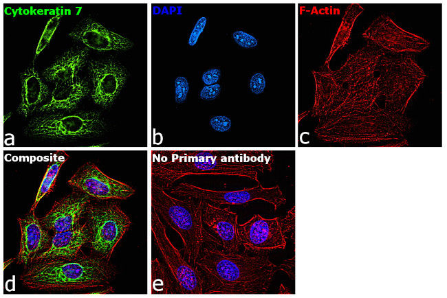 Cytokeratin 7 Antibody in Immunocytochemistry (ICC/IF)