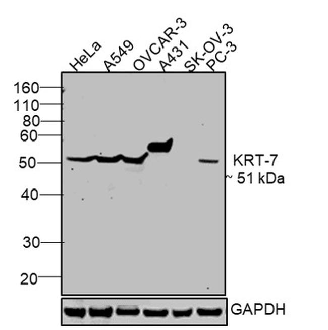 Cytokeratin 7 Antibody in Western Blot (WB)