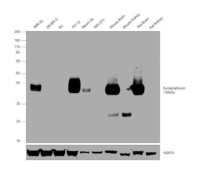 Synaptophysin Antibody