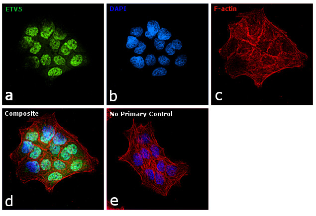 ETV5 Antibody in Immunocytochemistry (ICC/IF)